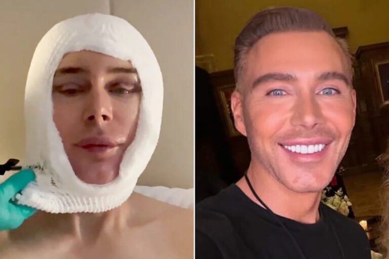 Celebrity facelift experience: kristofer buckle’s journey